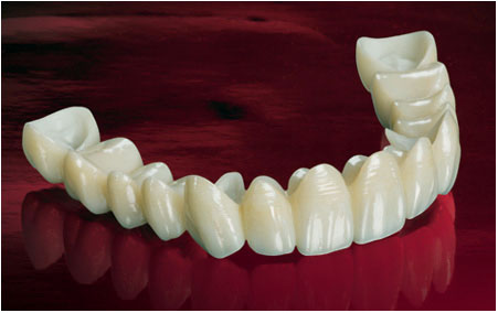How To Find the Best Zirconia Crown Price in India Without Compromising with The Quality